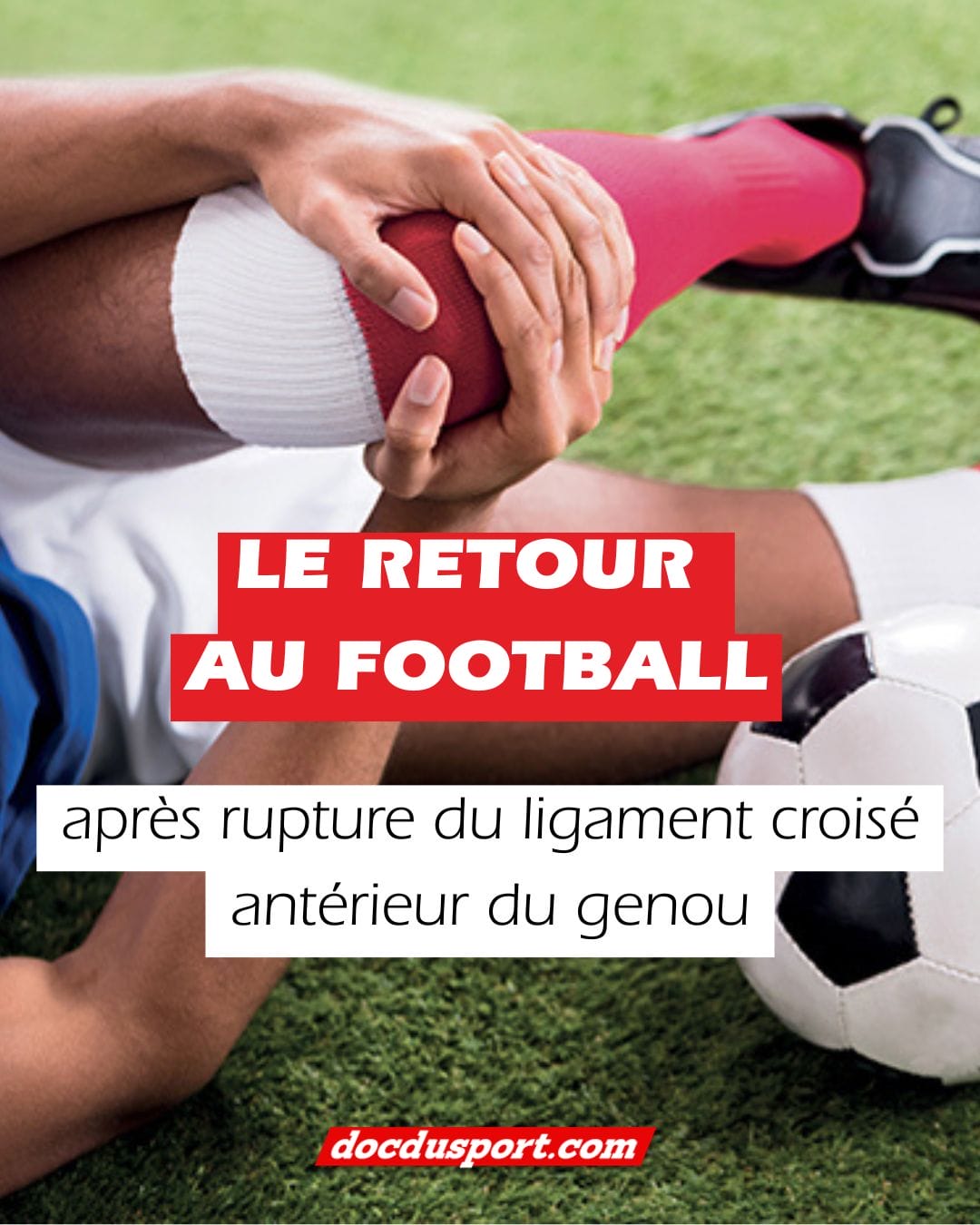 ⚽️ Reprendre le foot après un LCA : ce que personne ne vous dit vraiment…

La réalité est dure : après une rupture du ligament croisé antérieur, seulement 1 joueur amateur sur 2 retrouve son niveau d’avant.
Chez les pros, ils retrouvent le terrain… mais 22 % jouent à un niveau inférieur trois ans plus tard.

Pourquoi ?
Parce qu’un retour réussi ne dépend pas que de la chirurgie ou des muscles.
Il repose sur 3 piliers essentiels :
✔️ La force (tests isocinétiques)
✔️ Le contrôle biomécanique (hop tests…)
✔️ La psychologie (score ACL-RSI indispensable)

➡️ Et pour les pros, Clairefontaine a même développé un protocole complet : “11 to Perf”, l’évaluation la plus poussée pour sécuriser le retour au jeu.

L’article complet vous explique :
• Les chiffres réels du retour au foot
• Les critères fiables pour un retour en sécurité
• Les tests incontournables pour éviter la rechute
• Le rôle décisif de la réathlétisation spécifique
• Pourquoi les jeunes doivent attendre 10 à 12 mois

👉 Lire l’article sur www.docdusport.com (lien dans la bio).