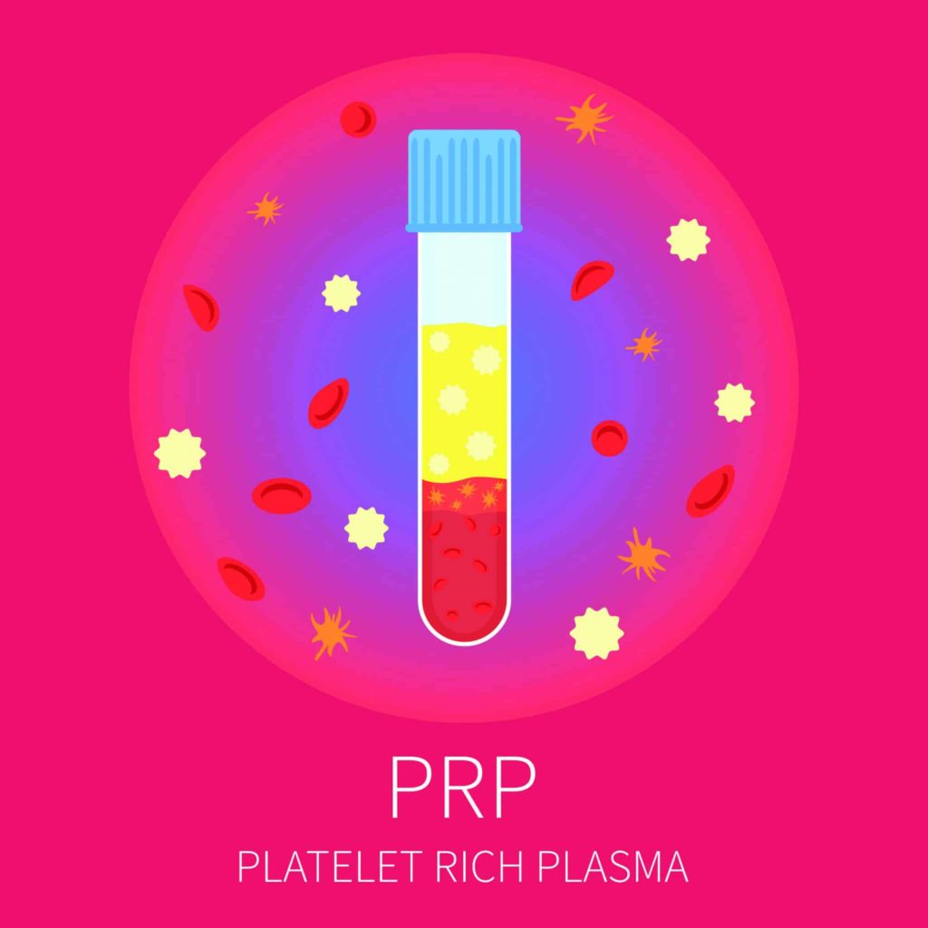 Contre-indications et Indications du Plasma Riche en Plaquettes (PRP)