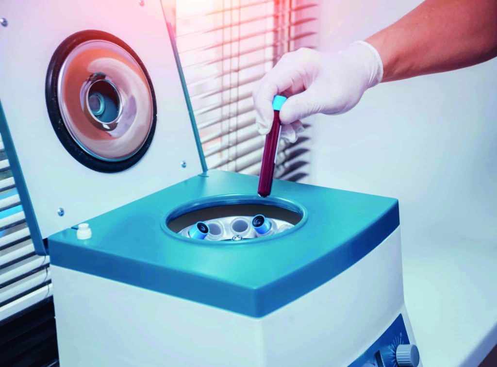 Fig. 1 : Mise en place du tube de prélèvement de sang dans la centrifugeuse.