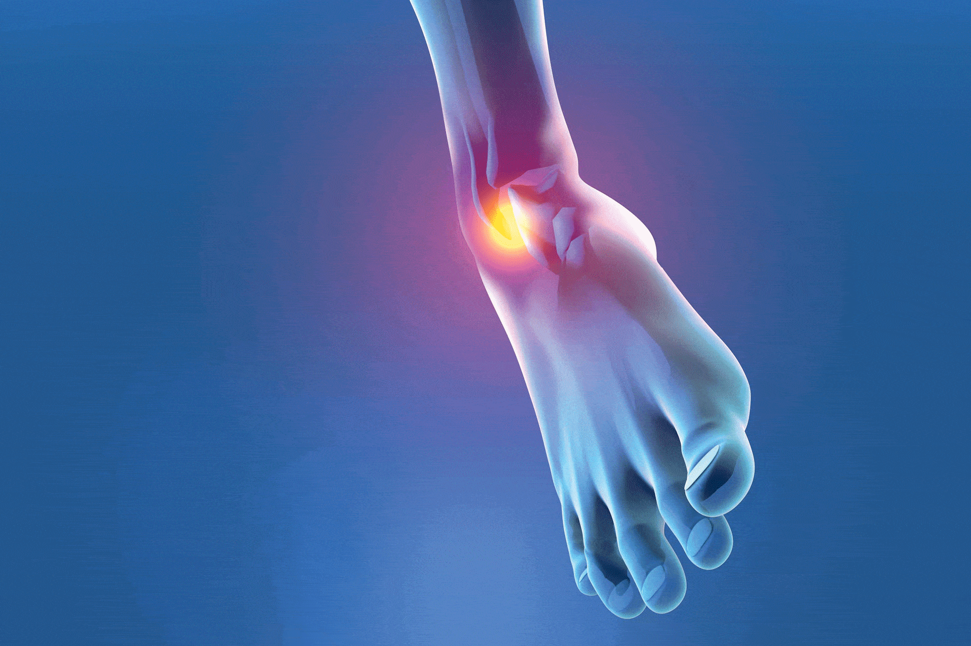 Tendinite et protocole de Stanish: des douleurs pour soigner vos tendons !