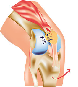 Figure 1: mouvement du genou