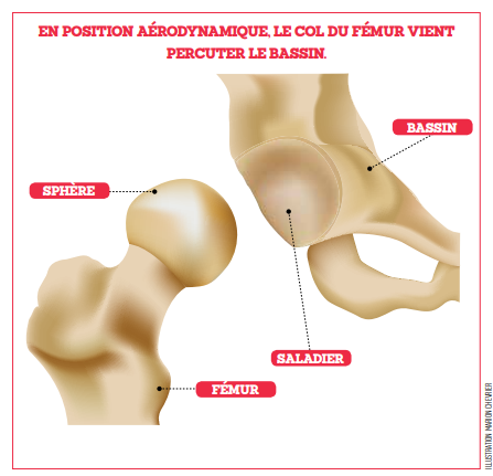 tendinite hanche : Comment la traiter rapidement ?