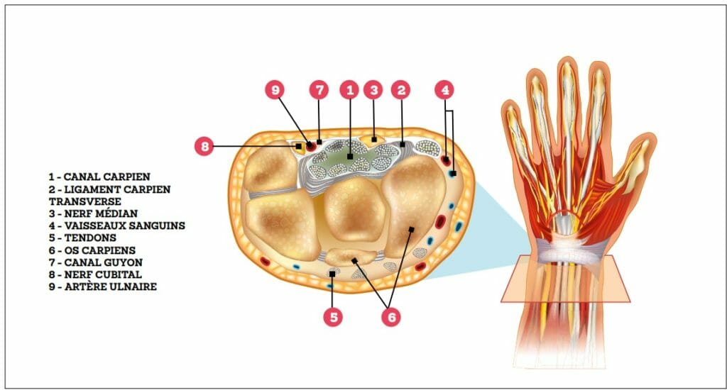 Syndrome du canal carpien: présentation anatomique
