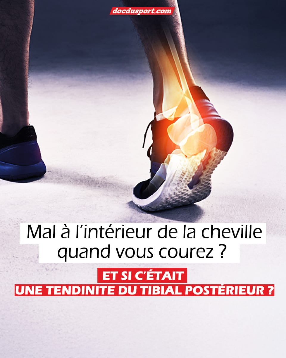 👉 Vous avez mal à l’intérieur de la cheville quand vous courez ?
Et si c’était une tendinite du tibial postérieur ?

Cette pathologie méconnue peut ruiner vos sorties si elle n’est pas prise en charge. Pourtant, pas besoin d’arrêter de courir !
Dans son dernier article, le @DocteurStephaneCascua vous explique comment soulager la douleur, adapter votre foulée, choisir la bonne chaussure… et même continuer à progresser. 💪

✔️ Pied plat, pronation, fatigue musculaire
✔️ Signes qui doivent vous alerter
✔️ Sports à privilégier pendant la douleur (vélo, natation, elliptique…)
✔️ Protocoles de reprise
✔️ Traitements naturels et médicaux (PRP, chevillère, etc.)

🎽 Un article à lire et partager avec vos partenaires d'entraînement.
🎯 Pour celles et ceux qui veulent courir longtemps… sans douleur !

📚 Lire l’article complet sur docdusport.com (lien dans la bio)