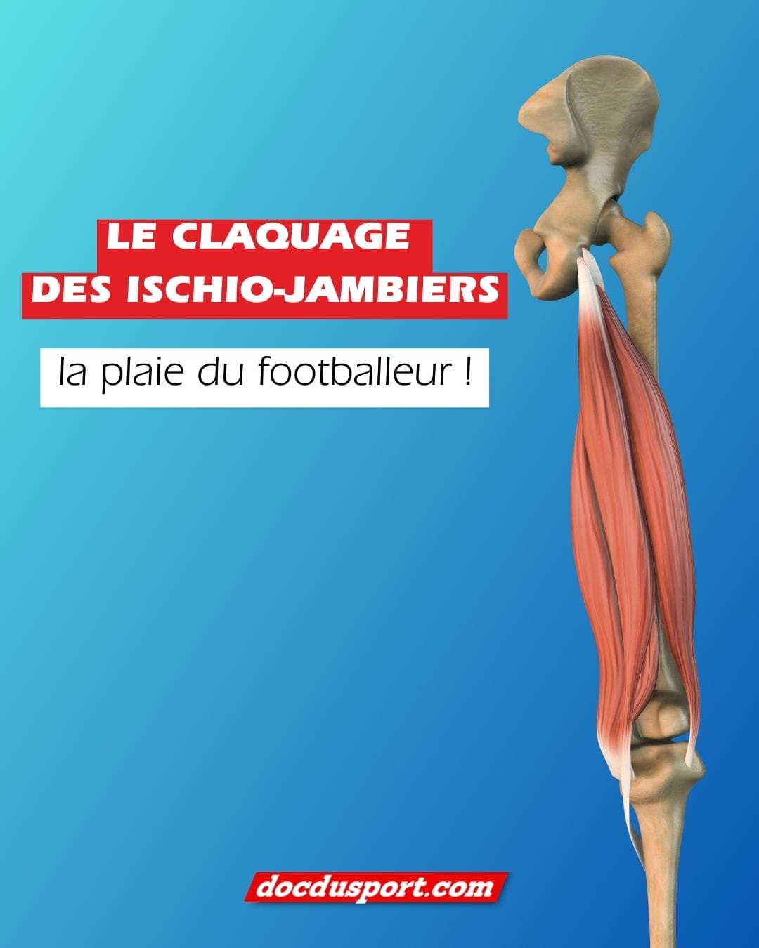 👟 Un sprint, un tir… et « CRAC ».
Si vous êtes footballeur, vous connaissez peut-être ce son trop bien.
Le claquage des ischios, c’est LA blessure qui peut vous sortir du terrain en une seconde.

Dans notre nouvel article, vous découvrirez :
🔥 La différence entre contracture, élongation, claquage, déchirure
🔥 Les signes qui doivent vraiment vous inquiéter
🔥 Ce qu’il faut faire immédiatement sur le terrain
🔥 Comment réussir sa rééducation sans rechuter
🔥 Le protocole GREC expliqué simplement

👉 Vous êtes footballeur, coureur ou sportif loisir ? Cet article est indispensable.
📲 À lire sur www.docdusport.com (lien dans la bio)