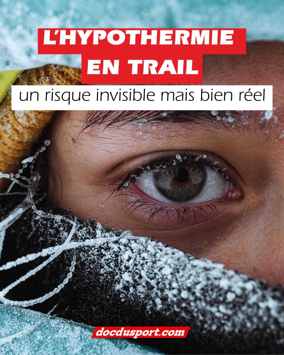 ❄️ Hypothermie en trail : le danger qu’on sous-estime tous !

Chaque hiver, des dizaines de coureurs sont pris en charge pour hypothermie, même sur des courses mythiques comme la SaintéLyon.
Le plus inquiétant ? Beaucoup ne reconnaissent pas les signaux… ou les confondent avec la fatigue.

Dans cet article, vous découvrirez :
✔️ Les 3 stades d’hypothermie et leurs symptômes
✔️ L’auto-test simple pour évaluer si vous êtes en danger
✔️ Les erreurs les plus fréquentes aux ravitaillements
✔️ Le rôle clé de l’alimentation, de l’allure et des pauses
✔️ Les conseils d’un cardiologue du sport pour prévenir le risque

👉 Lire l’article complet sur www.docdusport.com (lien dans la bio)