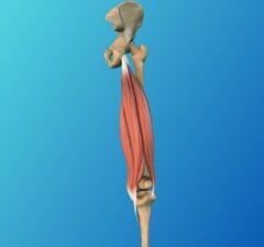 Le claquage des ischio-jambiers